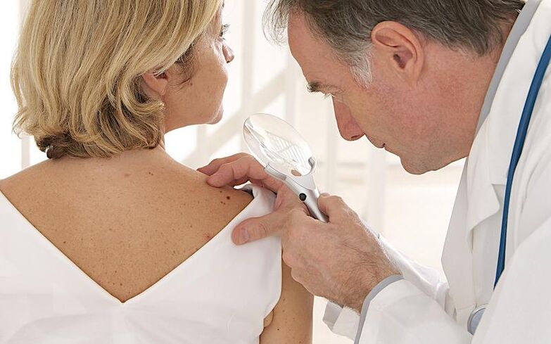 The woman with papilloma makes an appointment with her doctor before taking Removio gel