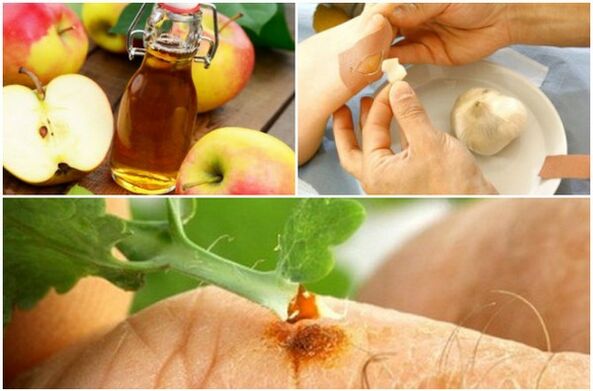 Folk remedies to treat warts